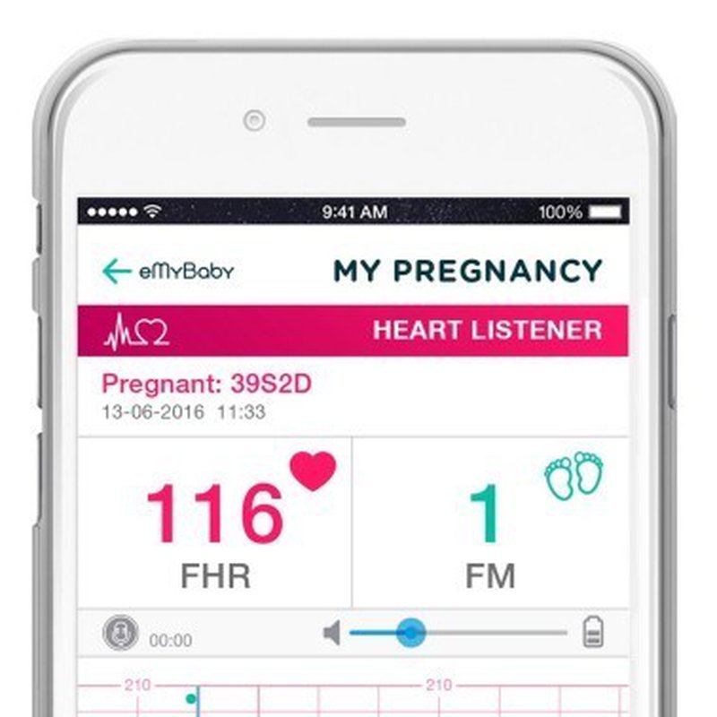 Miniland - Detektor tętna płodu sweetBeat